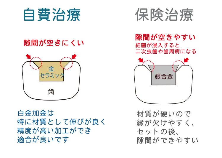 詰め物