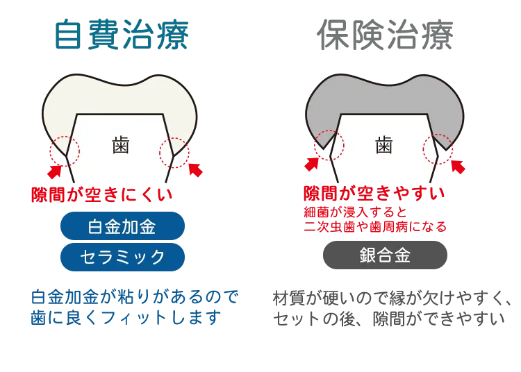 被せ物