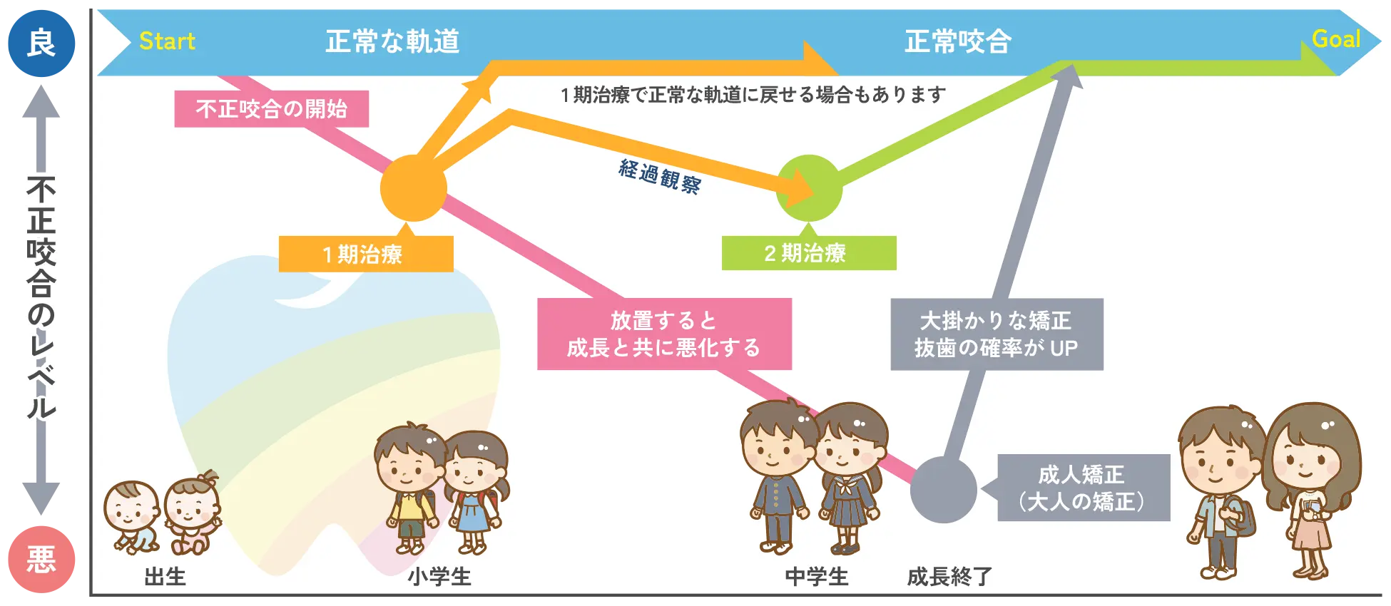 小児矯正歯科の治療の流れ