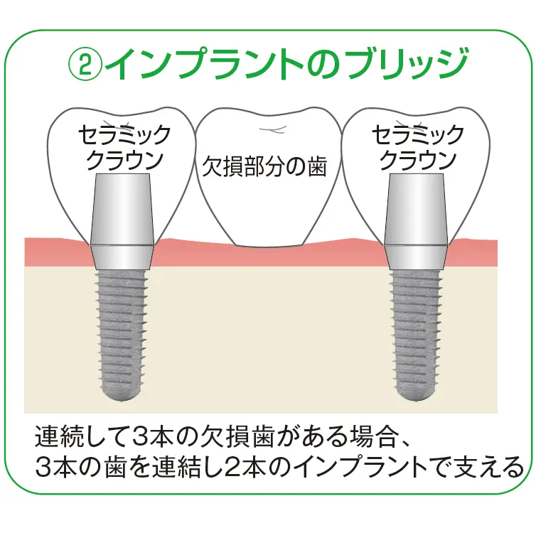 住吉区 ブリッジ