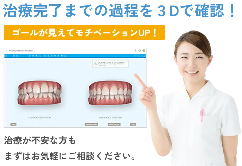 アウトカムシミュレーター