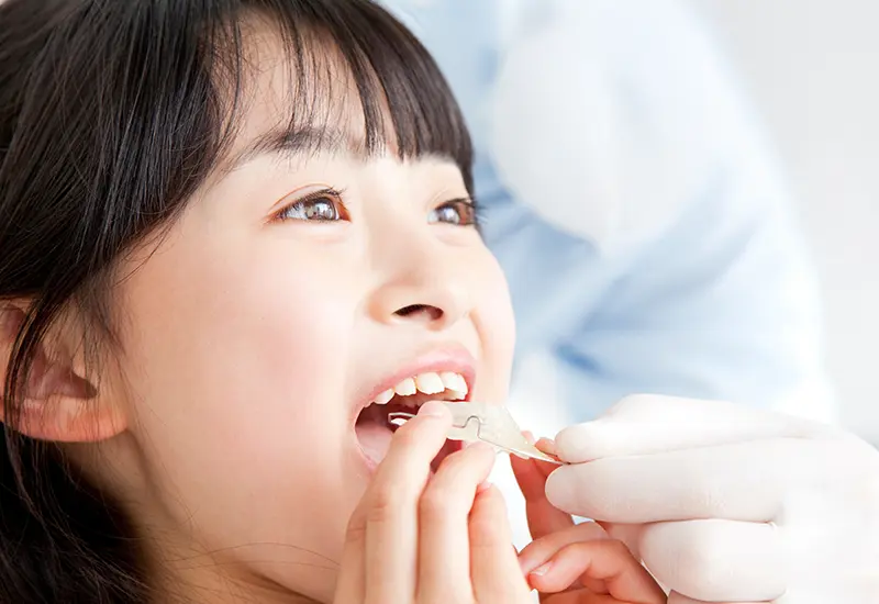 お子様の矯正にも対応